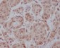 Anti-AKT1 Monoclonal Antibody